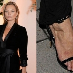 10 звезд с жутким педикюром, на который даже смотреть страшно