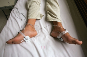 В психлечебницах Латвии наблюдается острая нехватка медперсонала