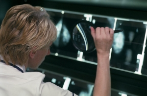 Из-за старой аппаратуры в Латвии рак груди выявляют слишком поздно