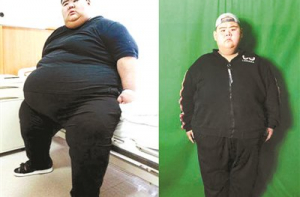 Самый тяжелый китаец за полгода похудел на 142 килограмма