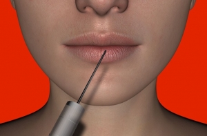 Статистика: все больше молодых людей прибегают к уколам ботокса