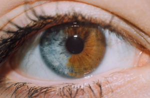 20 человек с редкими физическими особенностями