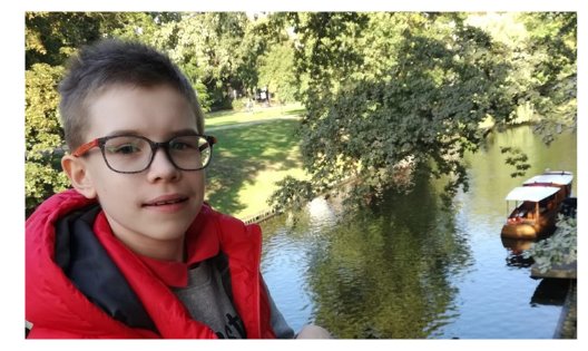 «Зеленая лампа»: для 13-летнего Артура, перенесшего три инсульта, собрано две трети нужной суммы