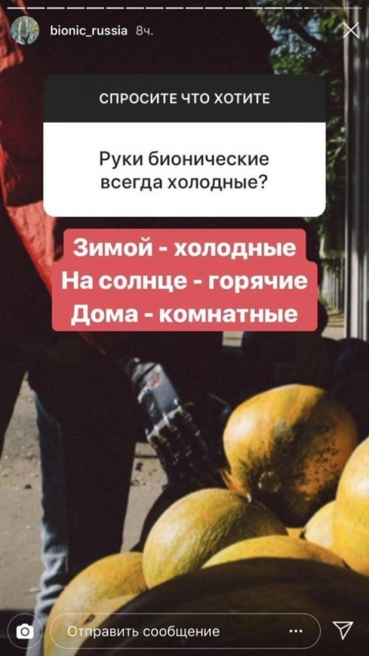 Парень с бионическими руками ответил на вопросы (6 фото)