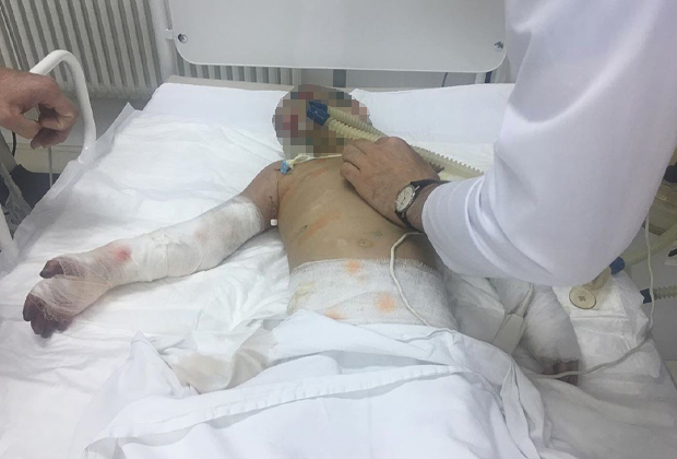 Как в фильме ужасов: в Ингушетии обнаружена девочка со следами пыток