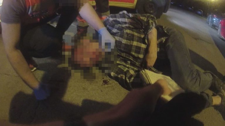 Драка в Зиепниеккалнсе: из-за девушки молодой парень разбил мужчине лицо и выбил зубы