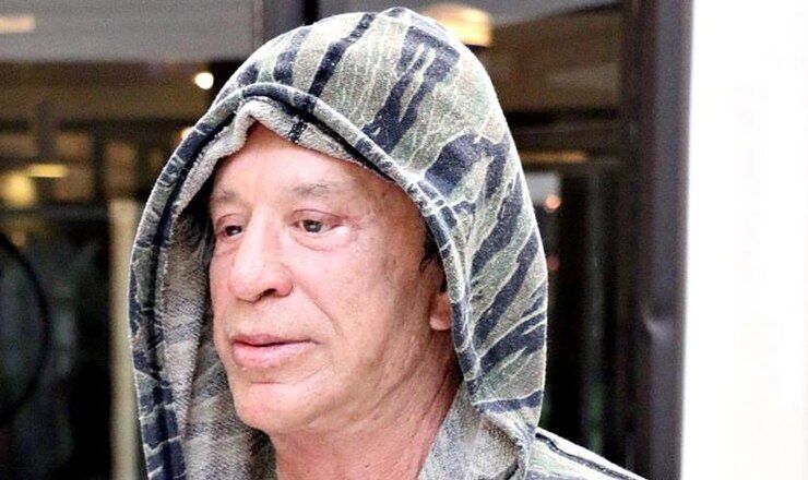 После очередной пластической операции Микки Рурка перестали узнавать