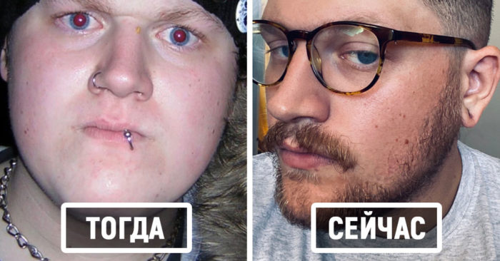 Из гадких утят в лебедей — как нескладные подростки стали красивыми взрослыми