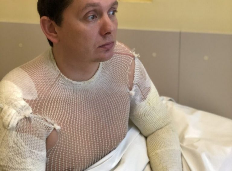 «До свадьбы заживет!»: Кайминьш ответил на вопросы о пожаре и компенсации от IKEA