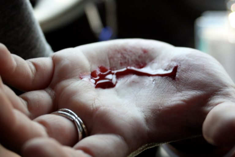 В Пурвциемсе трое мужчин устроили поножовщину из-за женщины (ВИДЕО)