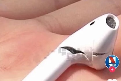 У жителя Китая в ухе взорвался AirPods
