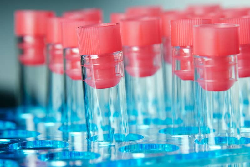 В Латвии четвертые сутки подряд не выявлены новые случаи COVID-19