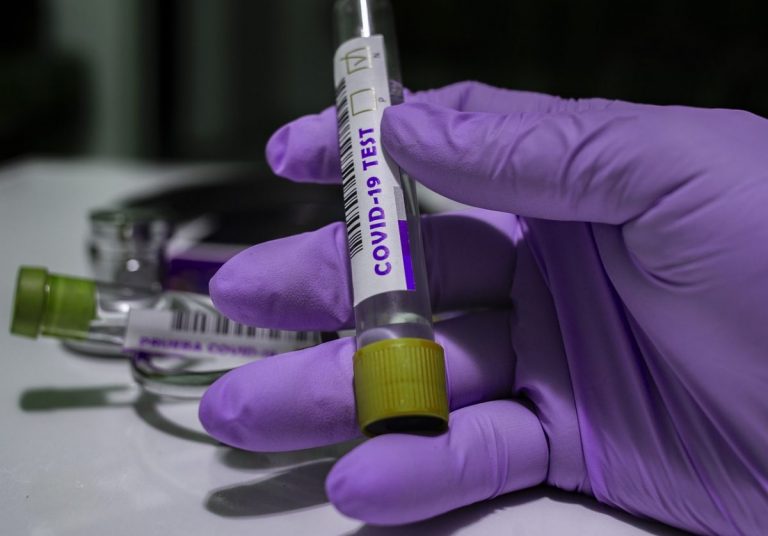 В Латвии за сутки выявлены семь новых случаев COVID-19