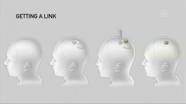 Илон Маск показал новую версию Neuralink и чипированную свинью