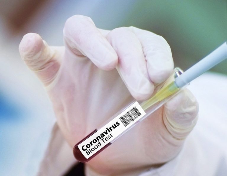 В Латвии выявлено 75 случаев COVID-19, один больной скончался