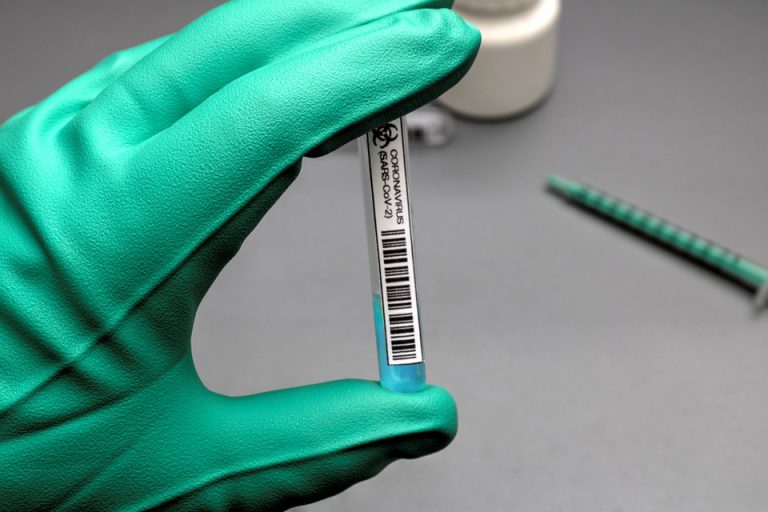 Разработан тест, определяющий COVID-19 за секунды