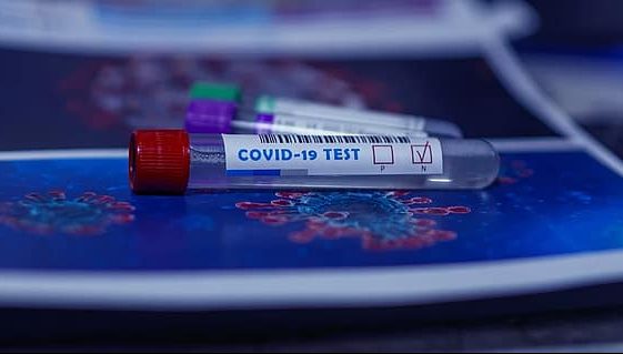 В Латвии за сутки выявлено 100 случаев COVID-19, девять человек умерли