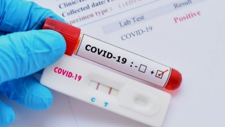 В Латвии за сутки выявлено 1367 случаев COVID, умерли 23 человека