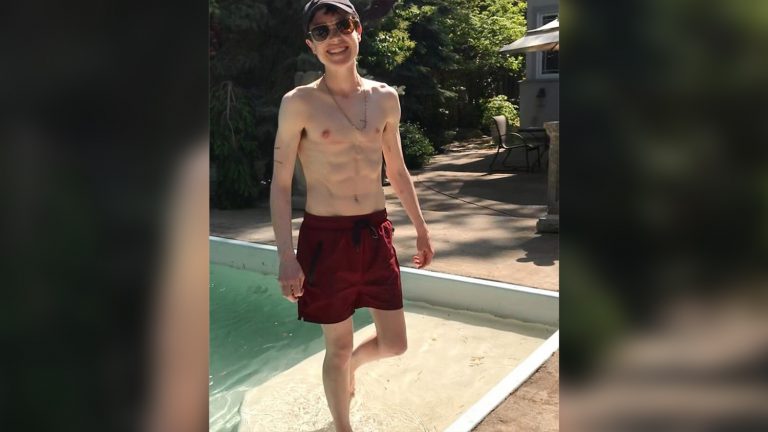 Актер Эллиот Пейдж опубликовал снимок в шортах после удаления груди (ФОТО)