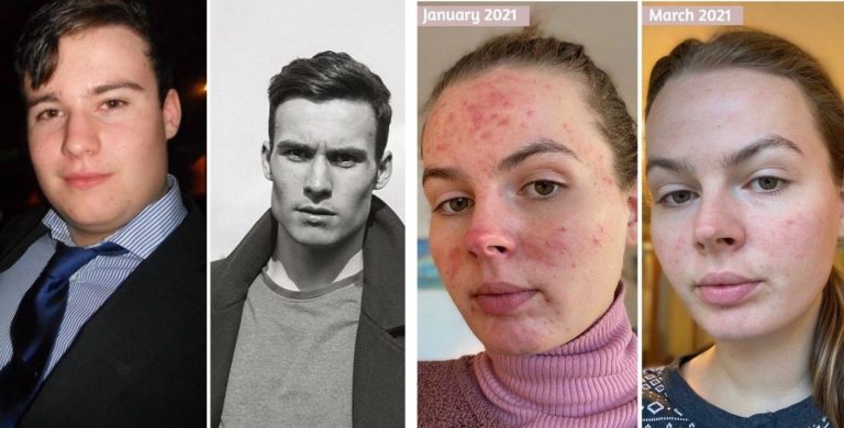 20 фото «до и после», от людей, которые отказались плыть по течению