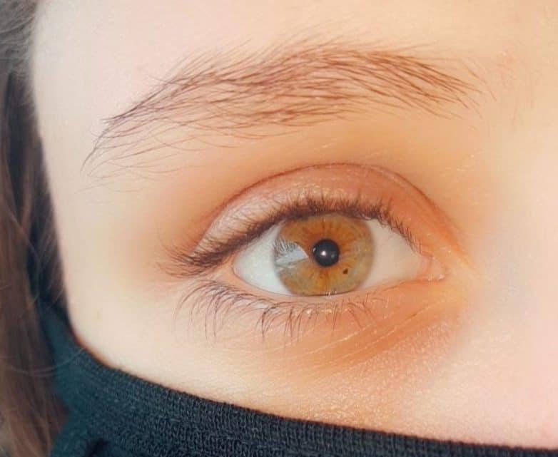 Когда ты не такой, как все: 17 человек с удивительными изюминками во внешности