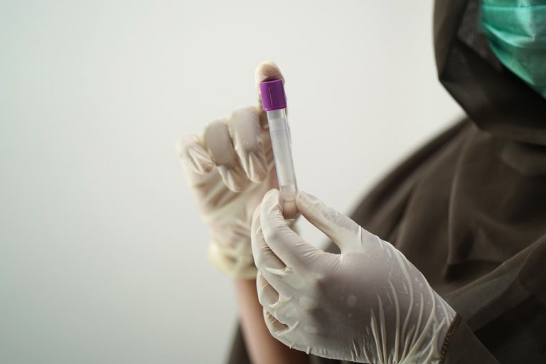 В Латвии за сутки выявлены 108 случаев COVID, три человека умерли