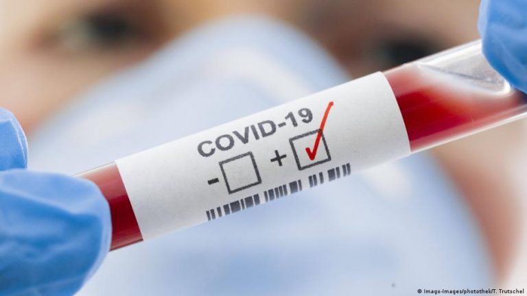 В Латвии выявлен 1501 новый случай COVID, скончались 79 человек