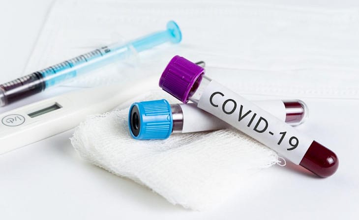 В Латвии выявлено 617 новых случаев COVID, скончались 20 человек