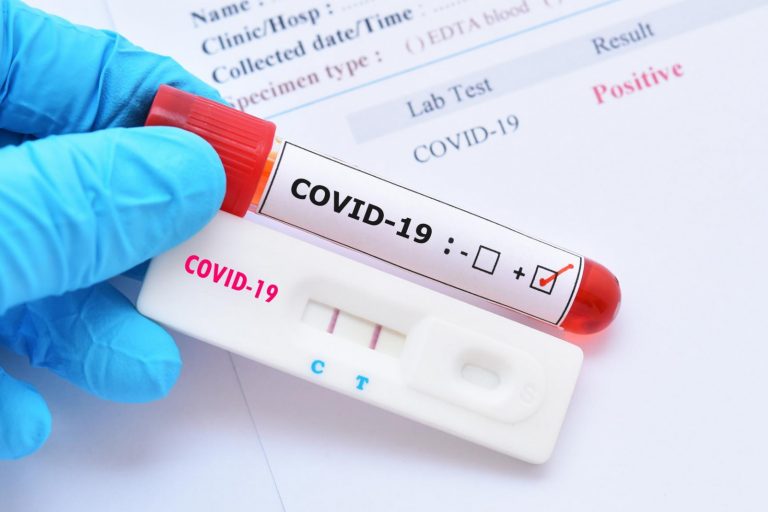 В Латвии выявлено 11 105 новых случаев  COVID, скончались 12 человек