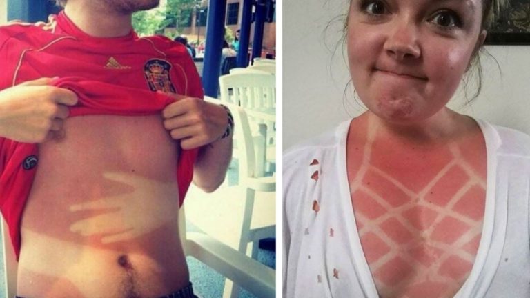 Неудачники, которые решили загореть, и им это явно не понравилось