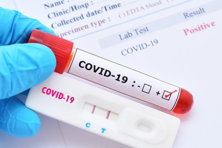 В Латвии за три дня выявлено 329 новых случаев COVID
