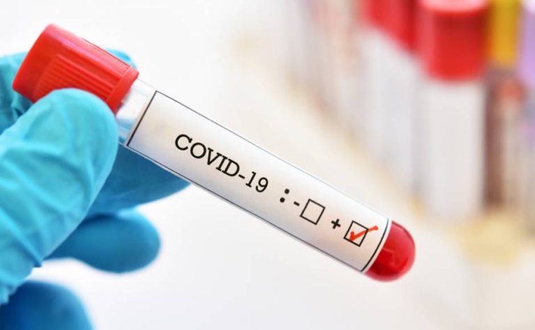 За три дня подтверждено 723 новых случая «Covid-19», сообщается о смерти 3 человек