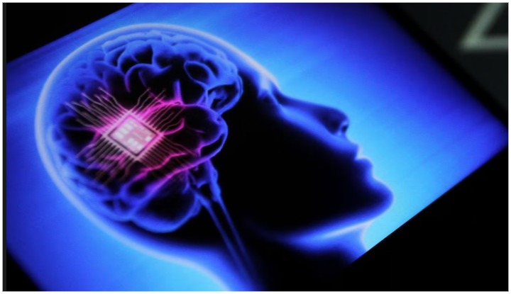 Мозговой чип Neuralink Илона Маска дал сбой: имплант отделяется от мозга пациента