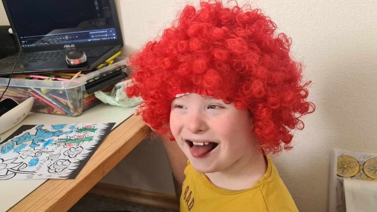 Звезда по имени Патрик: 12-летнему рижанину c cиндромом Дауна нужна помощь на оплату жизненно важной терапии