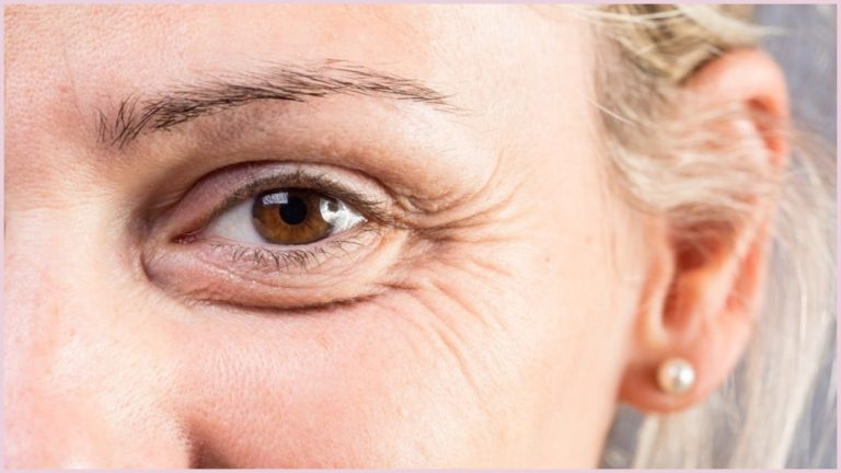 Морщины на лице: 5 привычек, которые их провоцируют, и что действительно помогает