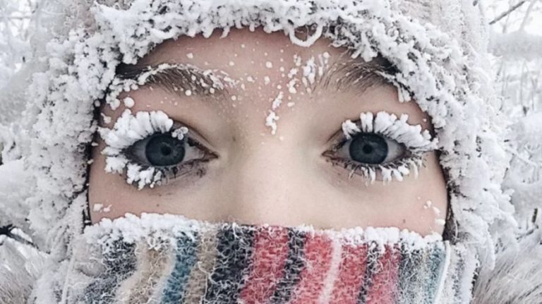 Тяжелая статистика января: 21 пациент с серьезными обморожениями, проведено 13 ампутаций - РВКУБ